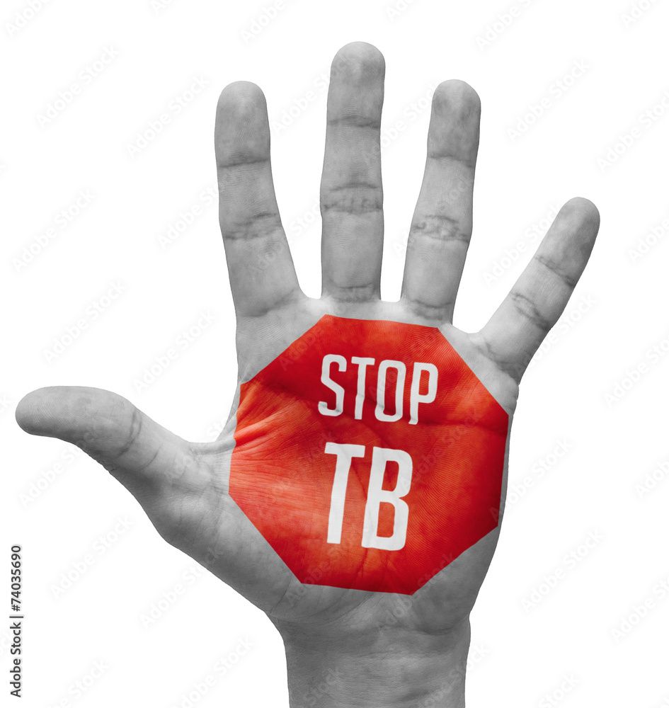 Партнерство «СТОП ТБ»  «Остановить Туберкулез» – «СТОП ТБ» – это ведущее государственно-частное глобальное партнерство, учрежденное в 2001 году. Целью его работы стало искоренение туберкулеза как проблемы в области здравоохранения и в конечном итоге избавление мира от этой инфекции. В Казахстане Национальное партнерство «СТОП ТБ» создано в 2017 году. Миссия сообщества – обеспечить доступ к эффективной диагностике и лечению для каждого больного туберкулезом, прервать трансмиссию инфекции, сократить социальный и экономический урон от нее, разработать и внедрить новые инструменты и стратегии для борьбы с заболеванием. Основная цель – к 2030 году положить конец эпидемии туберкулеза в соответствии с целями Организации Объединенных Наций по устойчивому развитию и стратегией Всемирной Организации Здравоохранения. Мы поддерживаем открытие представительств партнерства «СТОП ТБ» в регионах и понимаем важность продолжения информационных и адвокационных кампаний с привлечением лиц, принимающих решения на высоком уровне. Основным приоритетом становится получение государственного социального заказа для неправительственных организаций из местного бюджета, чтобы они могли решать вопросы, связанные с обследованием и повышением приверженности к лечению людей из ключевых групп населения, не имеющих документов и/или медицинской страховки. Чтобы исключить недостаточное финансирование инициатив общественных организаций по борьбе с туберкулезом, отсутствие последовательного и целенаправленного просвещения, малую активность организаций гражданского общества, в ноябре 2024 г. планируется открытие подразделения Национального партнерства «СТОП ТБ» для объединения усилий всех заинтересованных сторон на пути к ликвидации туберкулеза как эпидемии. Тема этого года «Мы сможем победить туберкулез!» привлекает внимание не только к заболеванию, но и к тому, что в наших общих силах покончить с туберкулезом как эпидемией к 2030 году и, следовательно, достичь целей устойчивого развития. Призываем всех коллег и заинтересованных лиц вступить в Национальное партнерство «Остановим туберкулез в Казахстане» и внести свой вклад в борьбу с этим заболеванием!  А.Әлмен и.о. ответственного за АКСМ по Туркестанской области и города Шымкент