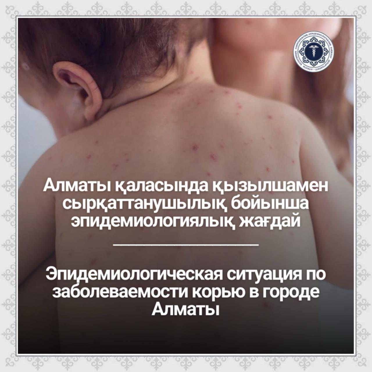 Алматы қаласында қызылшамен сырқаттанушылық бойынша эпидемиологиялық жағдай