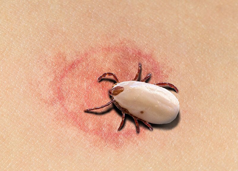 Наталья Орейроның аяқ фетиші