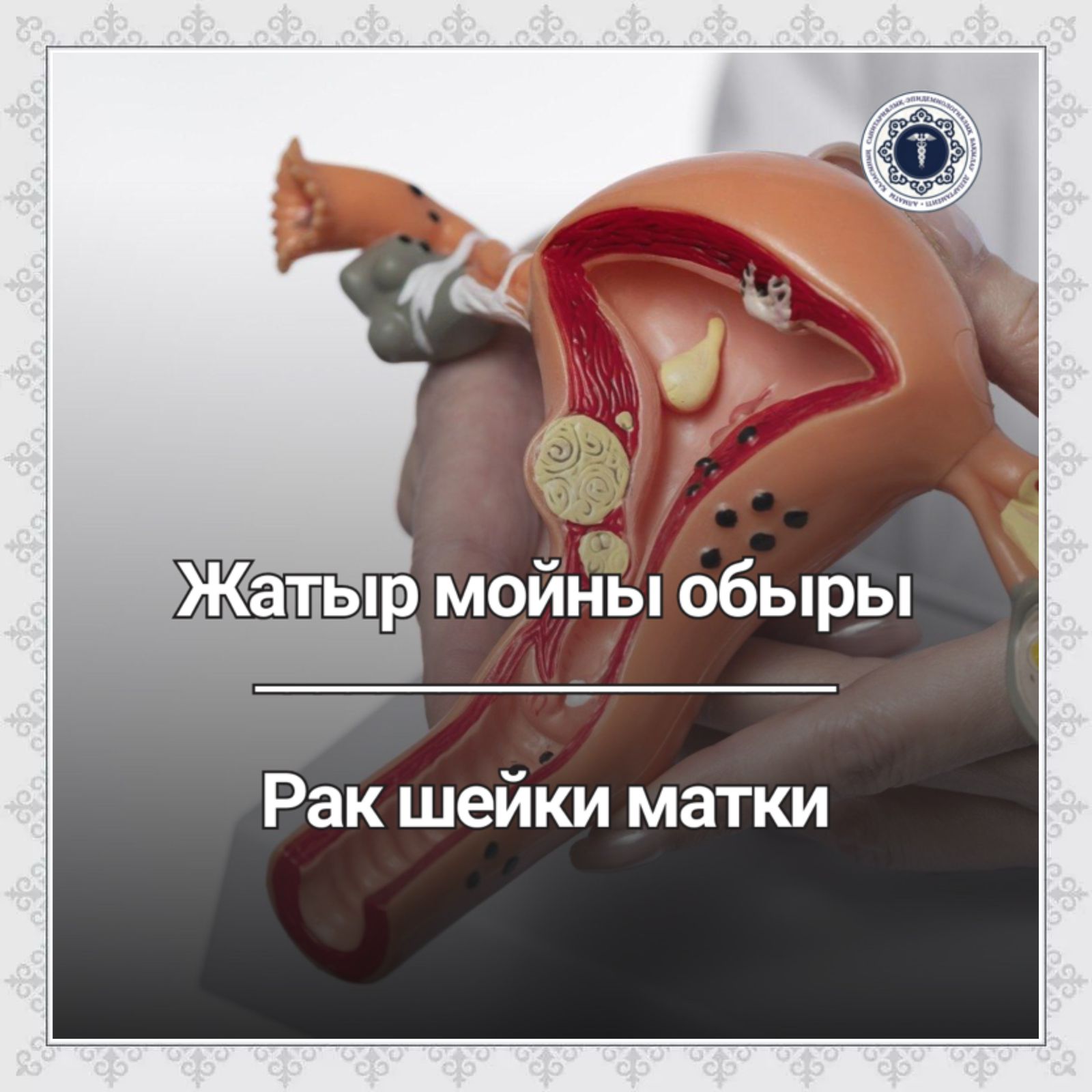 Жатыр мойны арқылы сперматозоидты енгізу