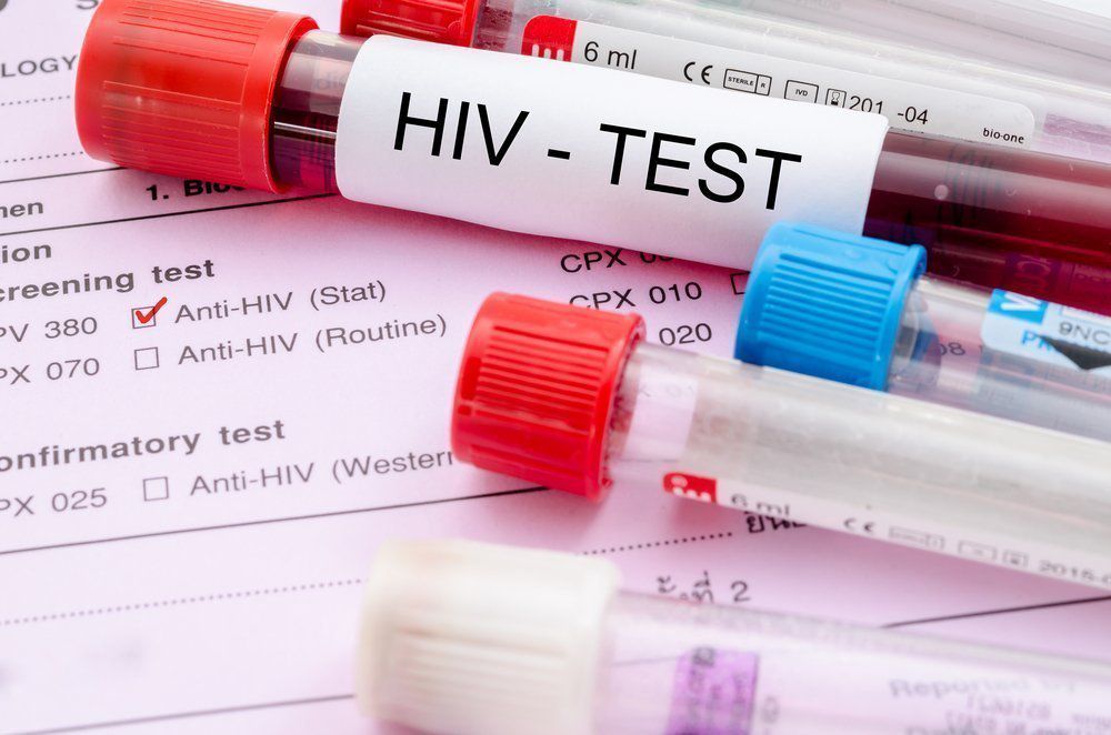 Новые подходы к профилактике ВИЧ: в столице смертность от СПИДа сократилась вдвое