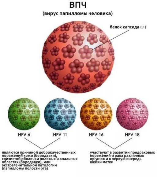 Как выглядит вирус папилломы человека у женщин Берут ли в армию с папилломами Отвечают юристы по призыву