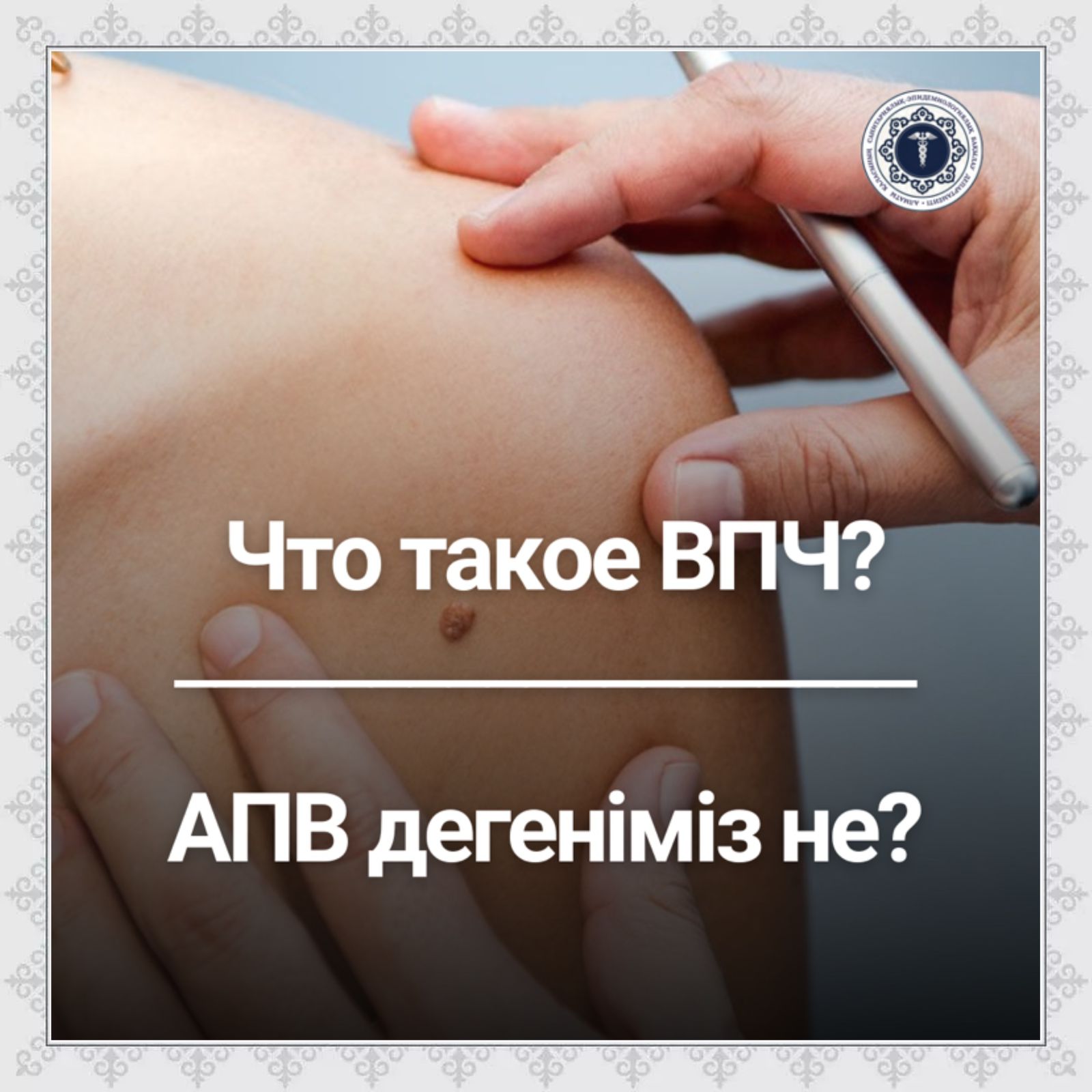 АПВ дегеніміз не?