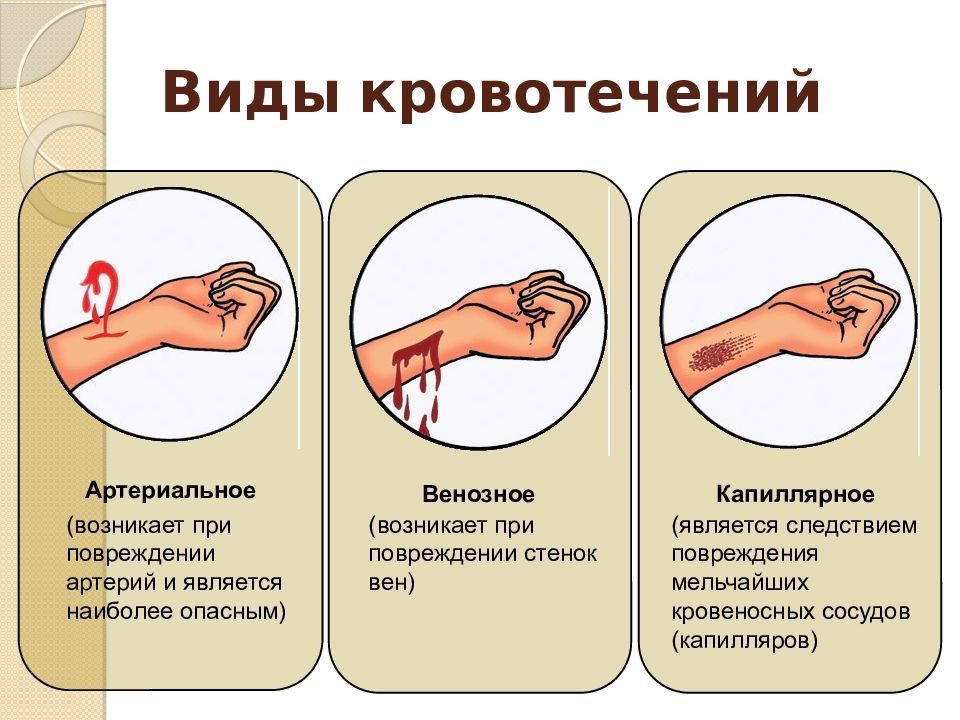 Қан кету кезіндегі әрекеттер