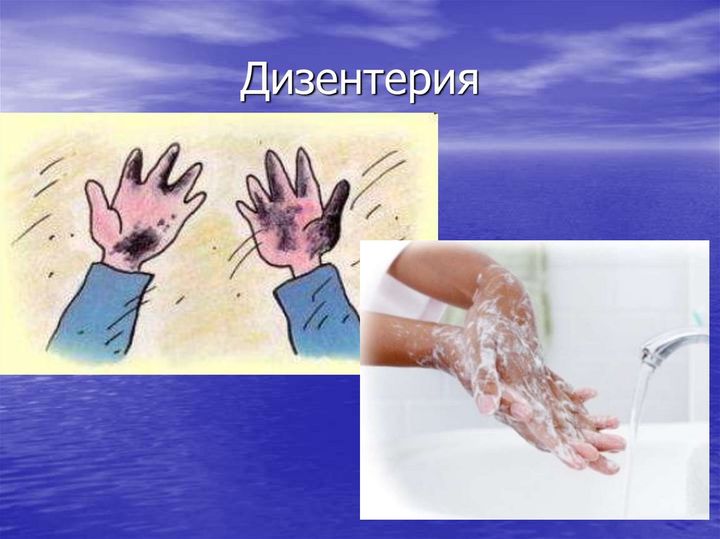 Вы знали, что до трех месяцев могут сохраняться симптомы дизентерии в случае заражения.