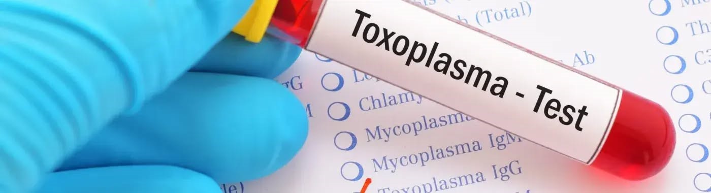 ТОКСОПЛАЗМОЗДЫҢ ҚАУІПТІЛІГІ.