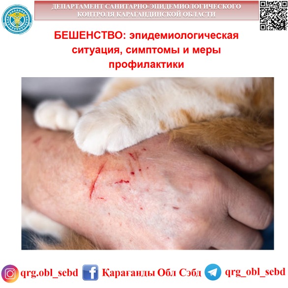 БЕШЕНСТВО: эпидемиологическая ситуация, симптомы и меры профилактики