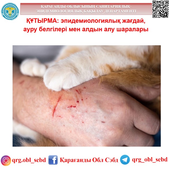 Анальды тығындағы порно көру