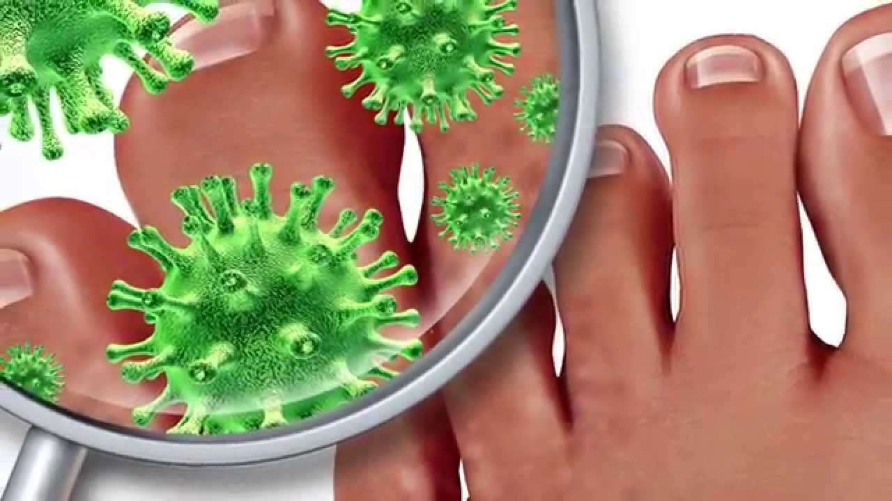 Дерматомикоздың алдын алу