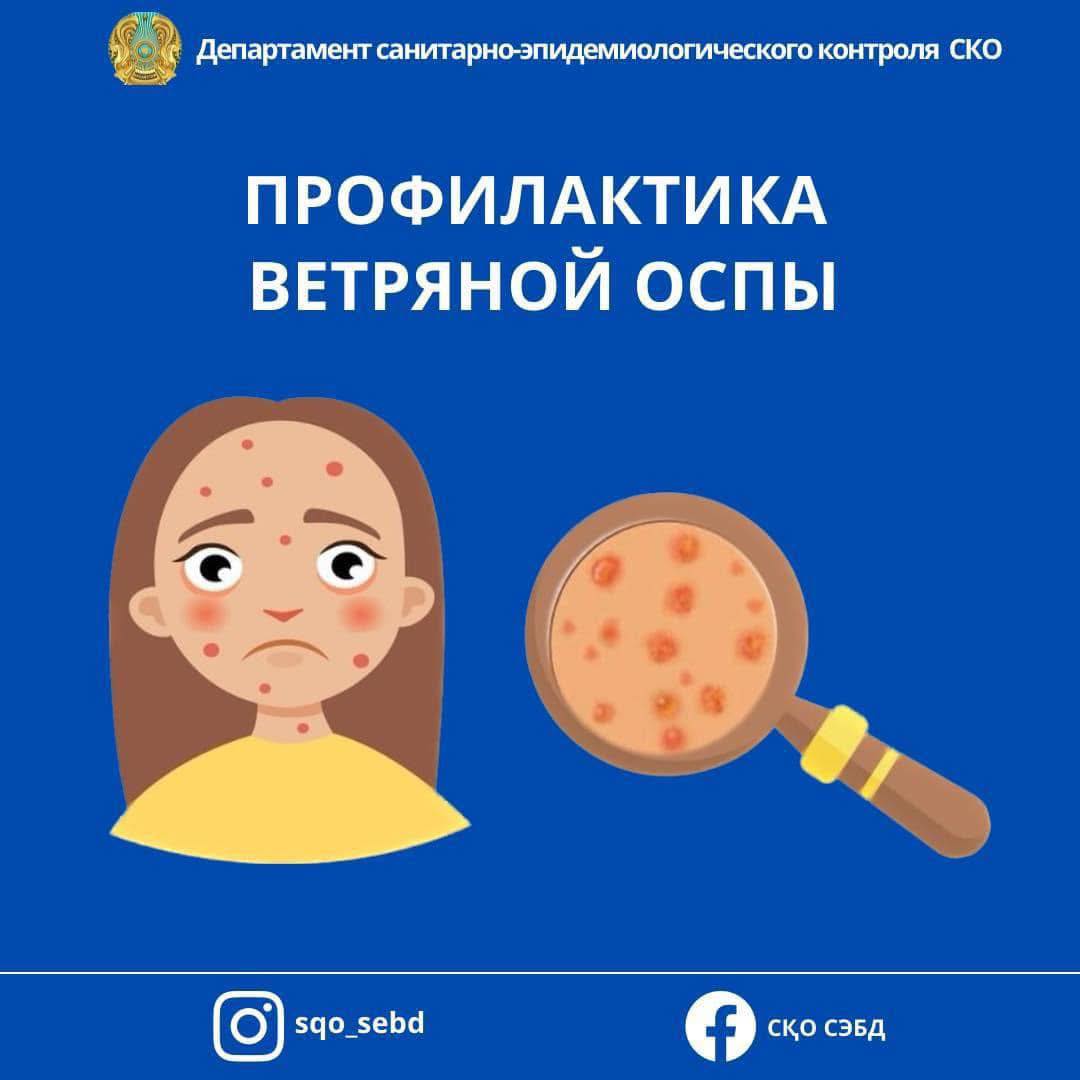 📌Профилактика ветряной оспы