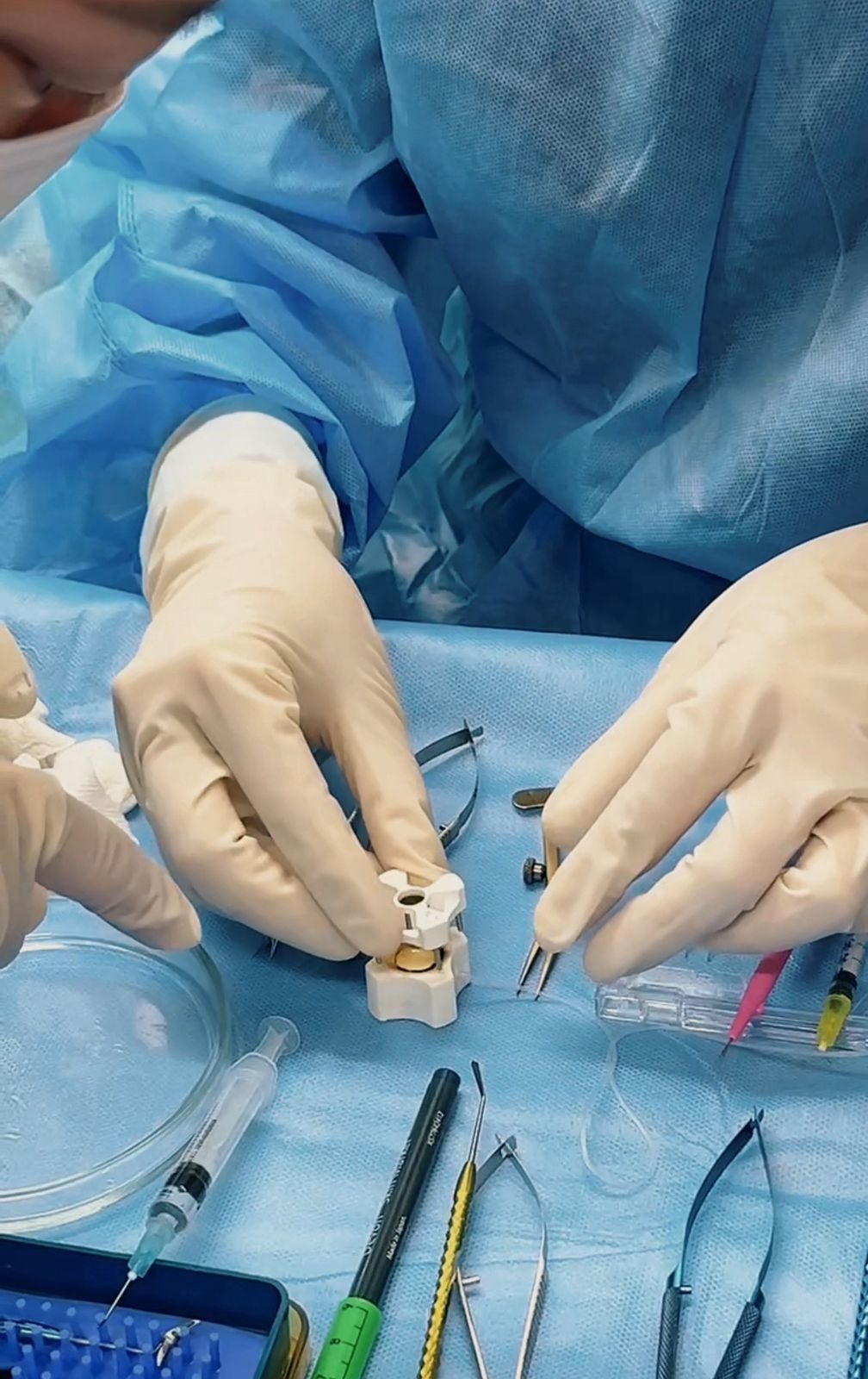 Алматы қаласы Орталық қалалық клиникалық аурухана офтольмологтары екі науқасқа қасаң қабақ ауыстыру арқылы көру қабілетін қайтарды