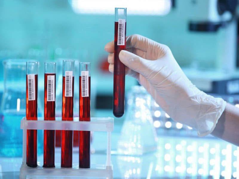 «Ауырып ем іздегенше, ауырмайтын жол ізде» деген дана халықпыз!!!