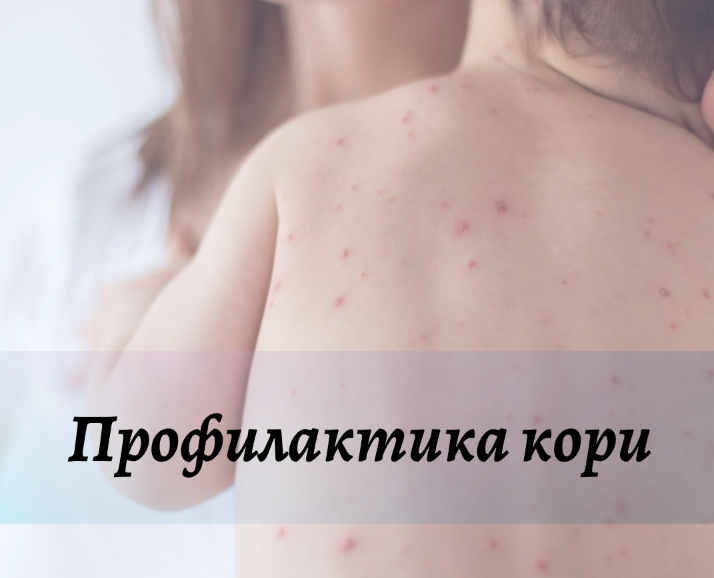 Профилактика кори
