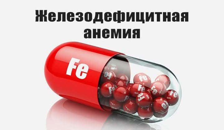 Темір тапшылықты анемия
