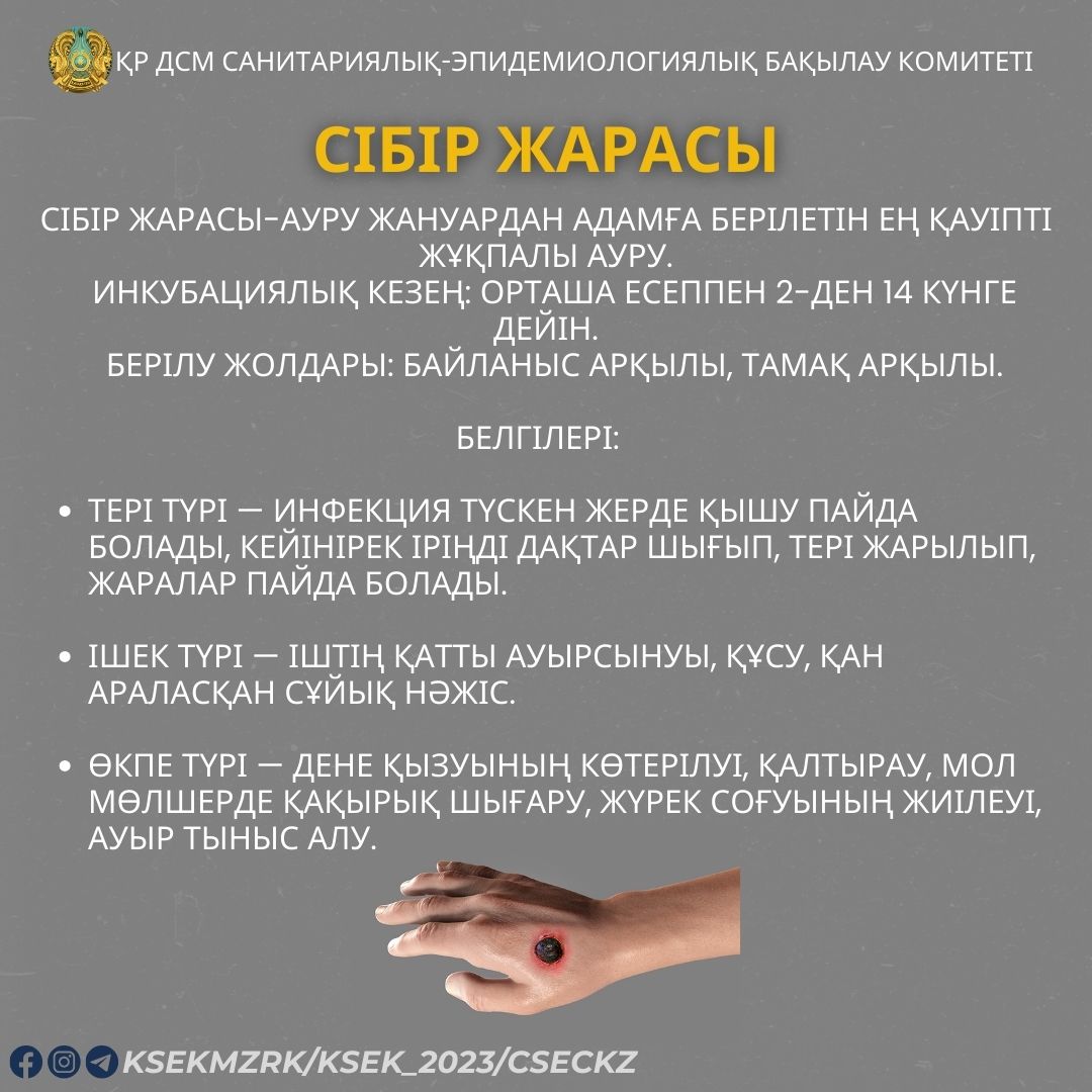 Сібір жарасы