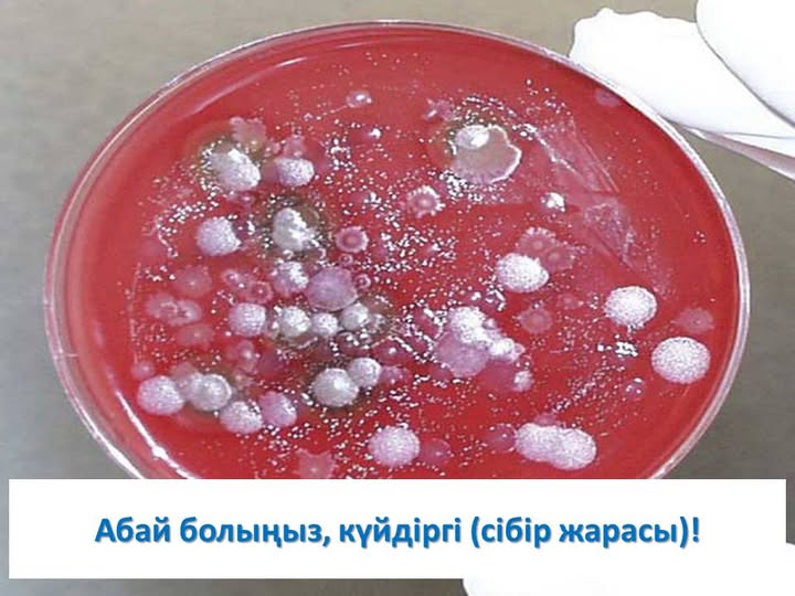 Абай болыңыз, күйдіргі (сібір жарасы)!