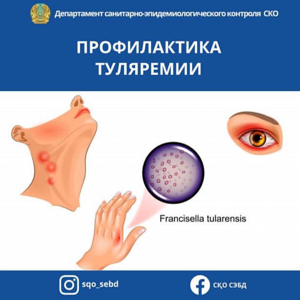 📌Туляремия – природно-очаговое инфекционное заболевание