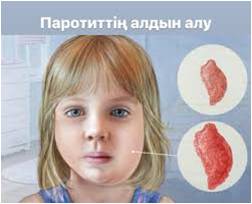Профилактика эпидемического паротита
