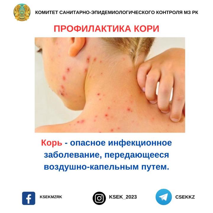 Профилактика кори