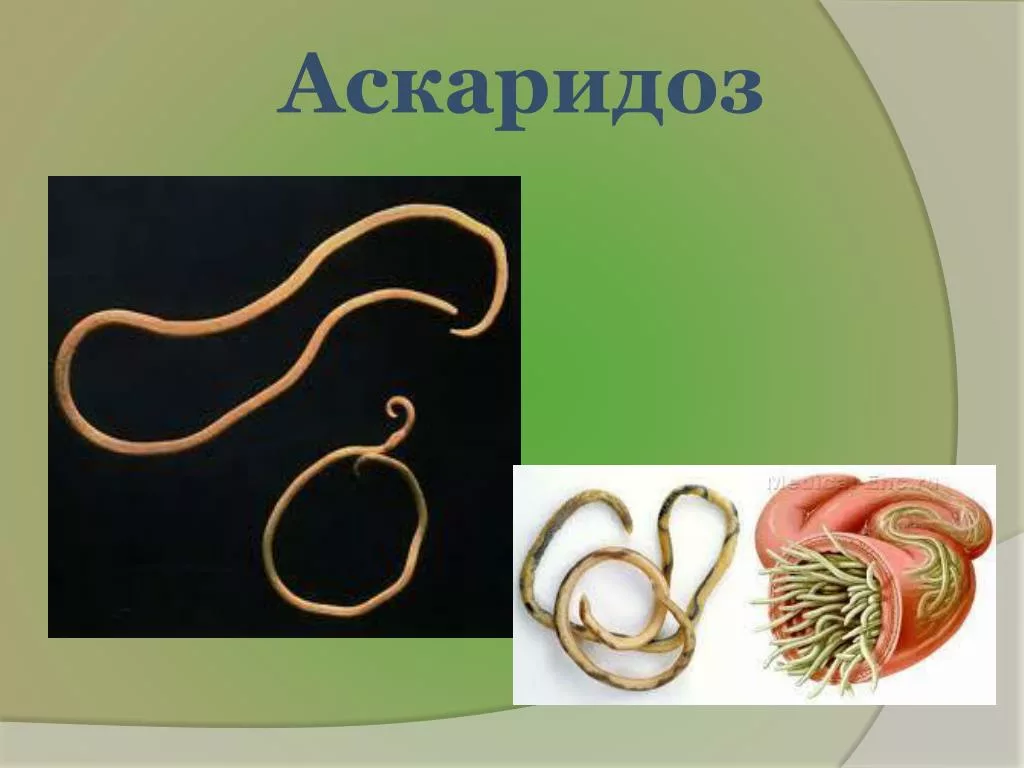 Аскаридоз алдын алу