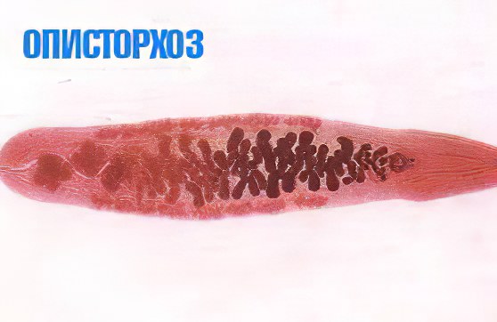 Профилактика описторхоза