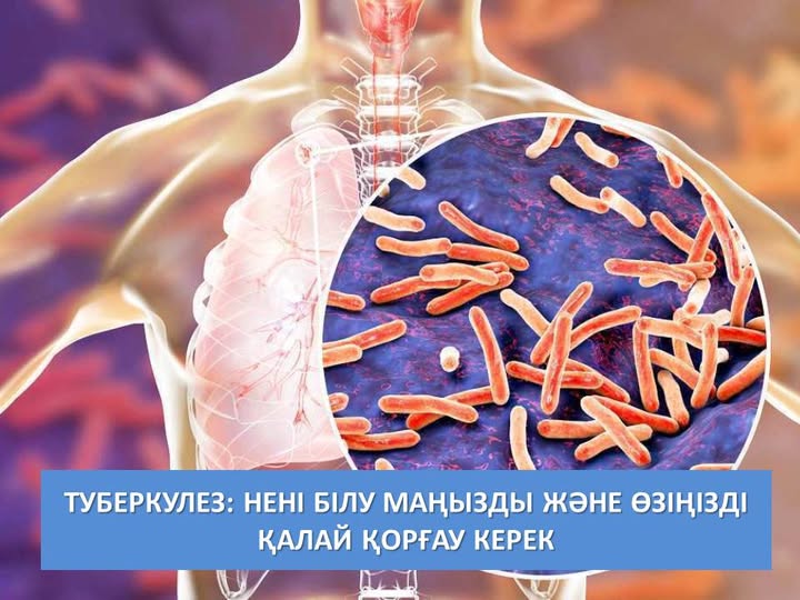 Туберкулез: нені білу маңызды және өзіңізді қалай қорғау керек