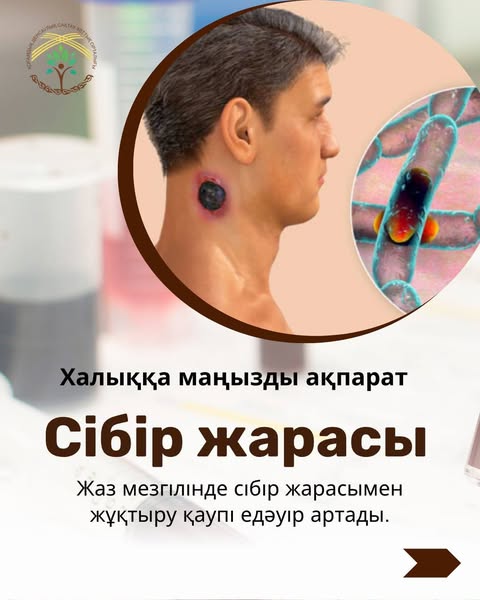 Сібір жарасы — ауыл шаруашылығы және жабайы жануарлардан адамға жұғатын аса қауіпті жұқпалы ауру.