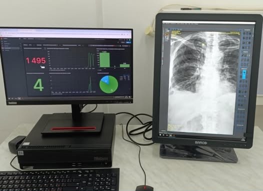 Жасанды интеллект қолданылатын телерадиология жобасы