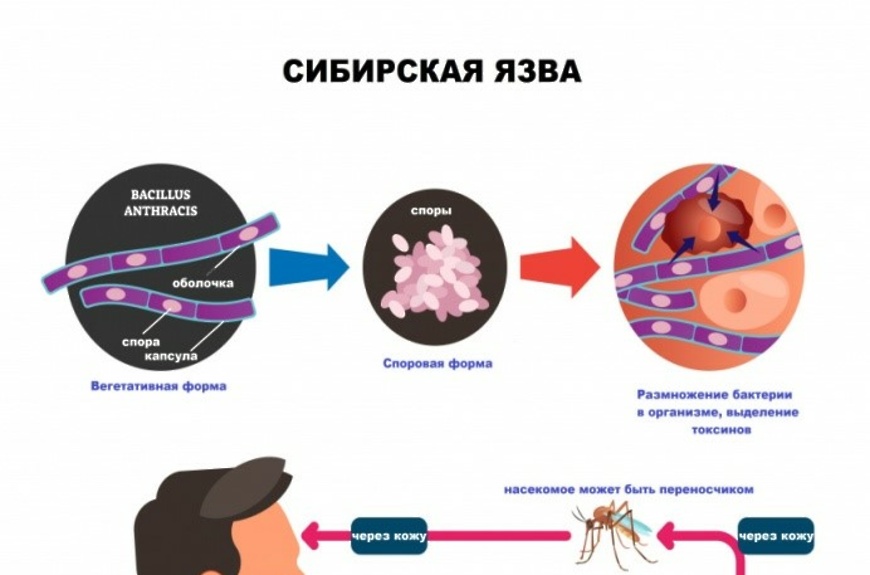 Памятка населению по  профилактике  сибирской язвы