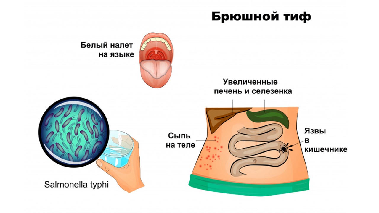 Іш сүзегі дегеніміз не?