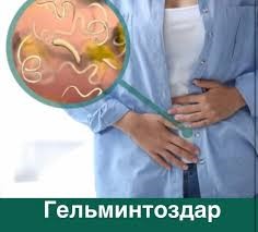 Гельминтоздар және оның алдын алу