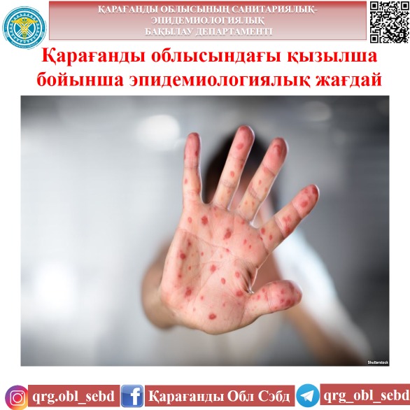 Қарағанды облысындағы қызылша бойынша эпидемиологиялық жағдай