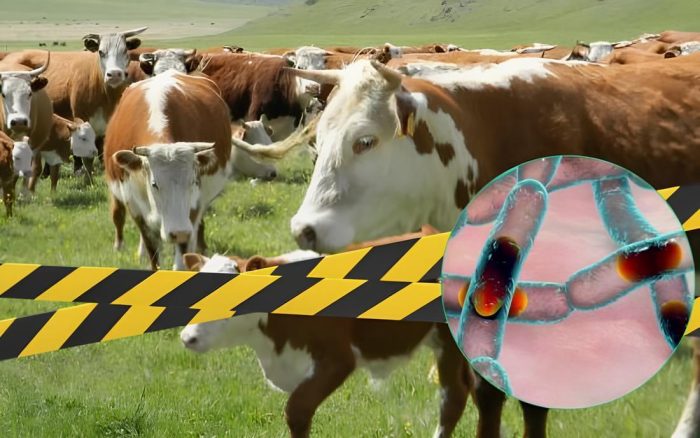 Сібір жарасының алдын алу