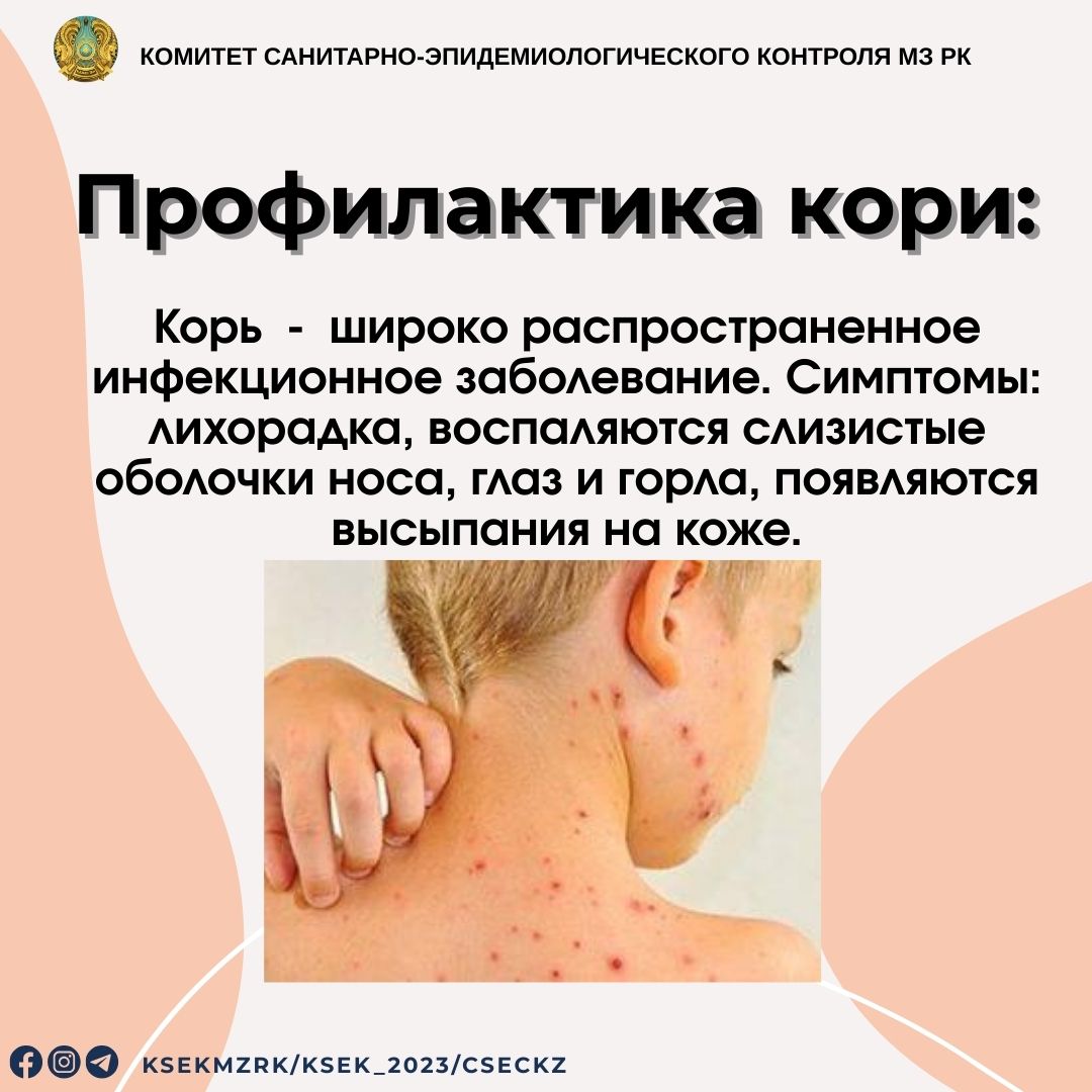 Профилактика кори