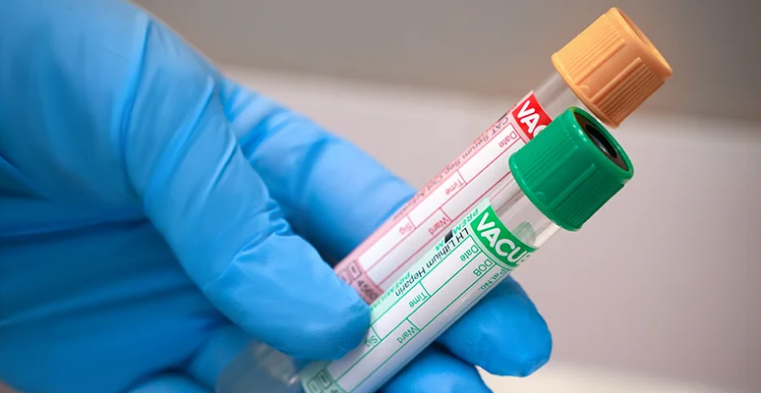 ЗЛОУПОТРЕБЛЕНИЕ ДОМИНИРУЮЩИМ ПОЛОЖЕНИЕМ СО СТОРОНЫ КОМПАНИИ INVIVO BUSINESS