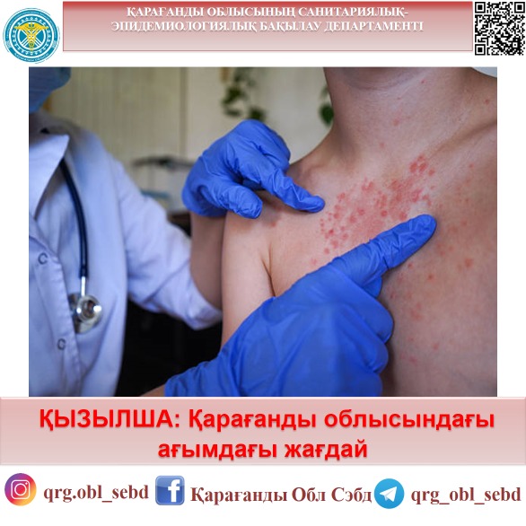 Қызылша: Қарағанды облысындағы ағымдағы жағдай