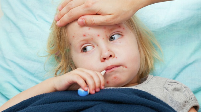 Қызылша — бұл ауа-тамшылы жолмен берілетін өте жұқпалы вирустық ауру.