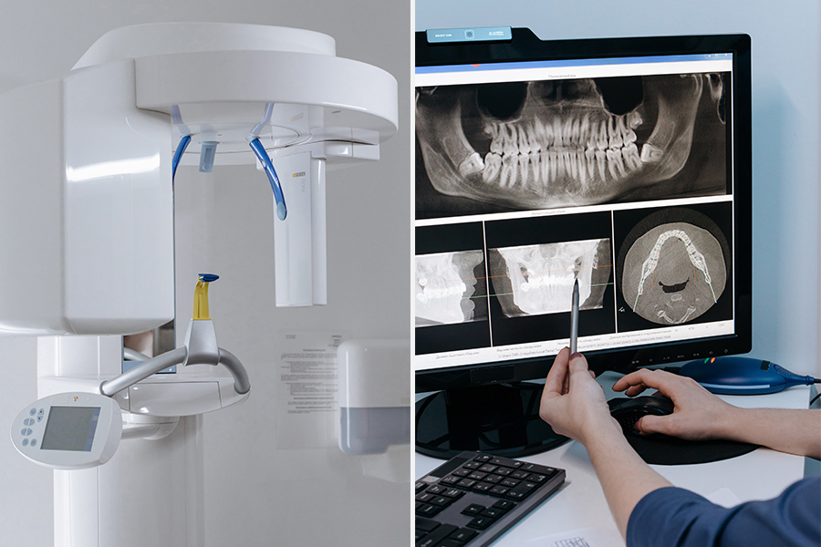 Рентген кабинеттеріне бару ережелері