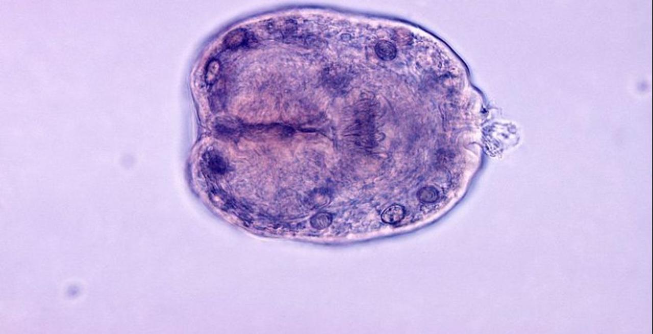 ⚜️Эхинококкоздың   алдын алу