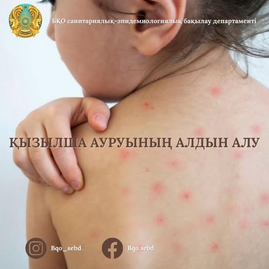 Қызылша ауруының алдын алу туралы