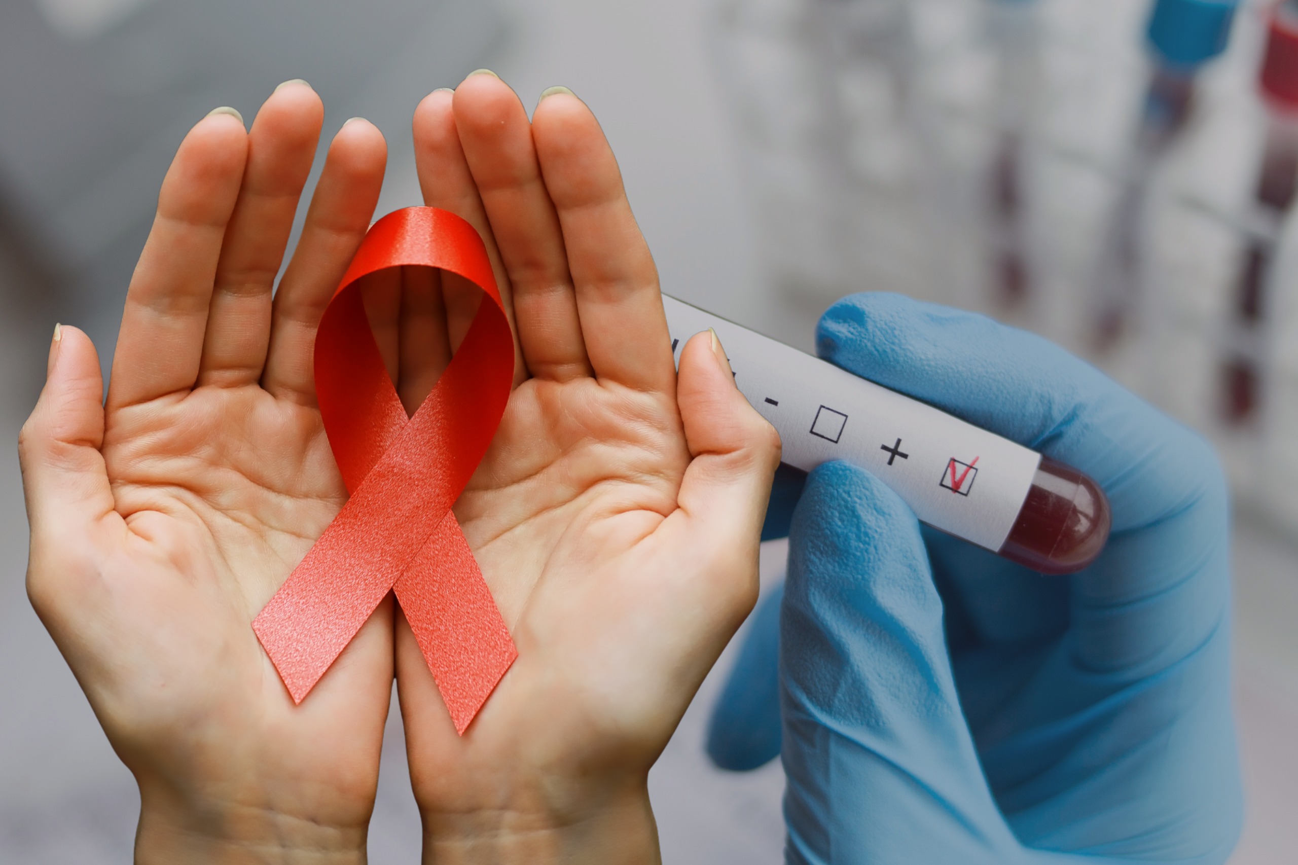 В Акмолинской области отмечается снижение новых случаев ВИЧ