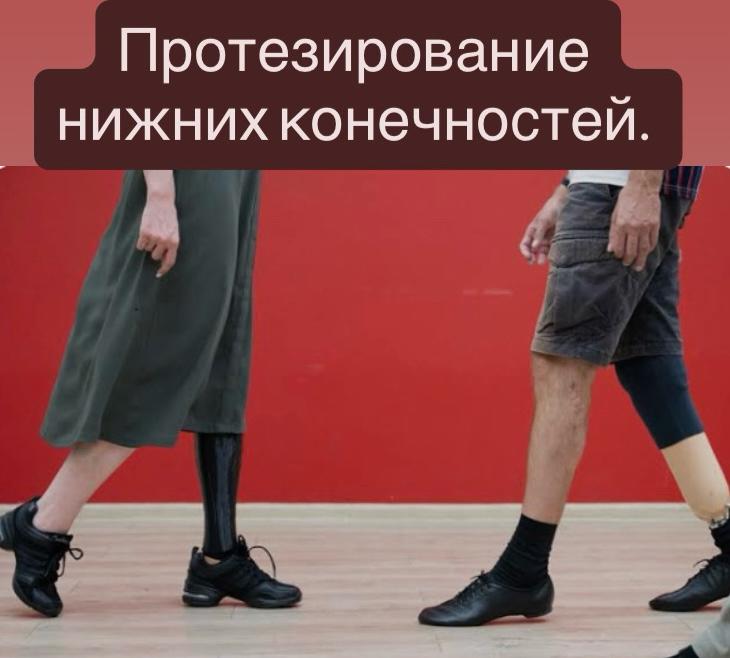 Аяқ протезін қалай тегін алуға болады?