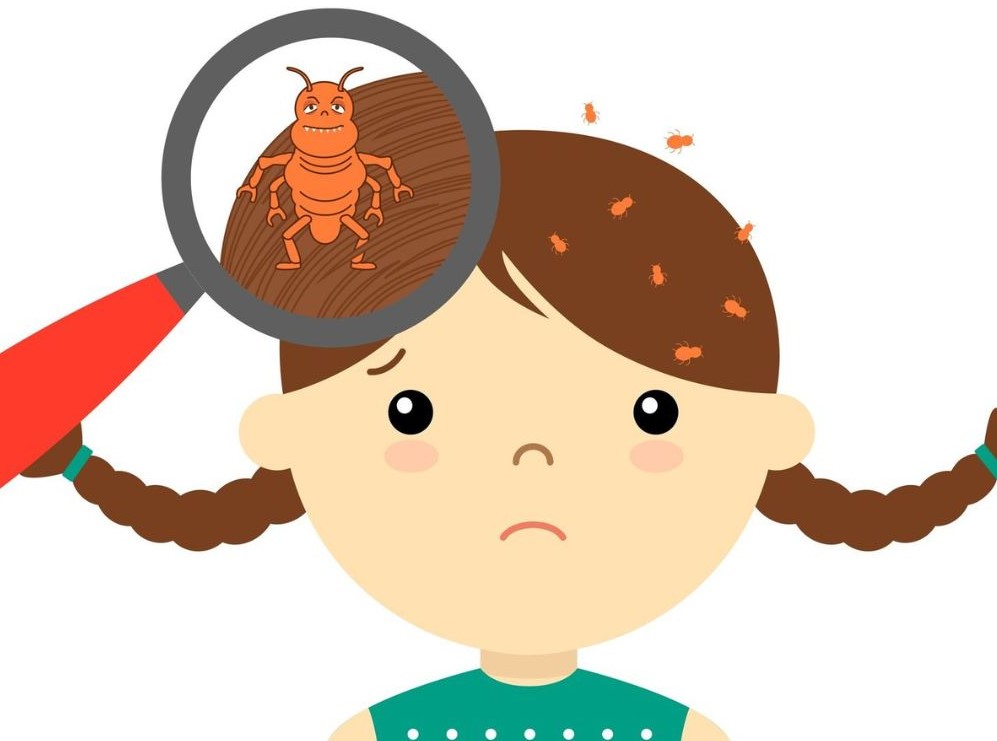 Педикулез дегеніміз не? Алдын алудың негізгі шаралары