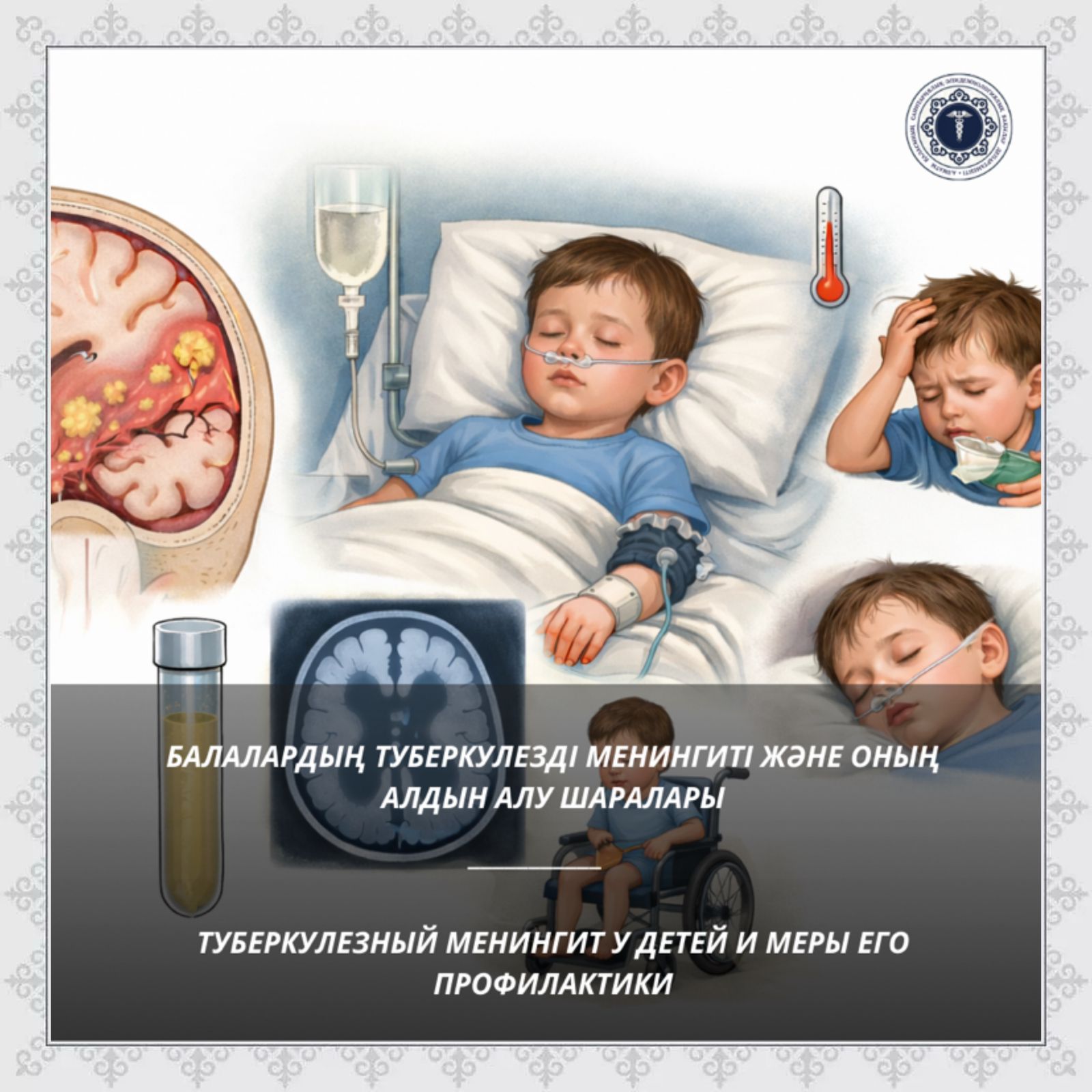 Балалардың туберкулезді менингиті және оның алдын алу шаралары