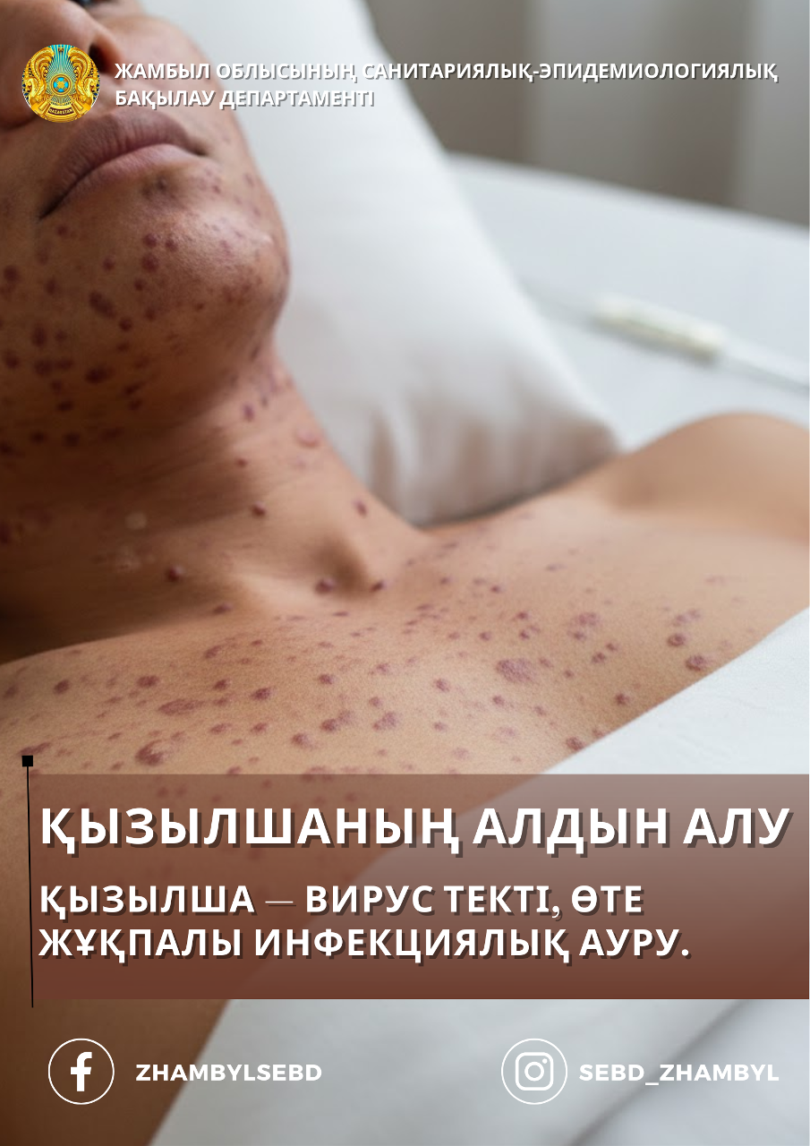 ҚЫЗЫЛШАНЫҢ АЛДЫН АЛУ