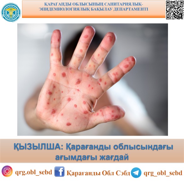 ҚЫЗЫЛША: Қарағанды облысындағы ағымдағы жағдай