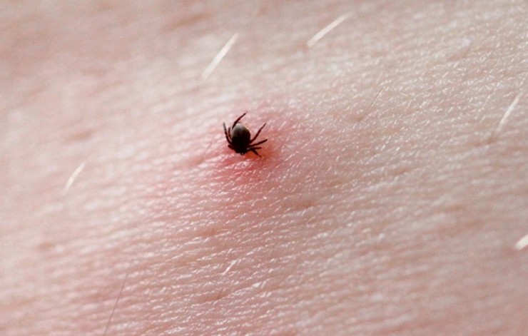 Кене энцефалитіне қарсы екпе