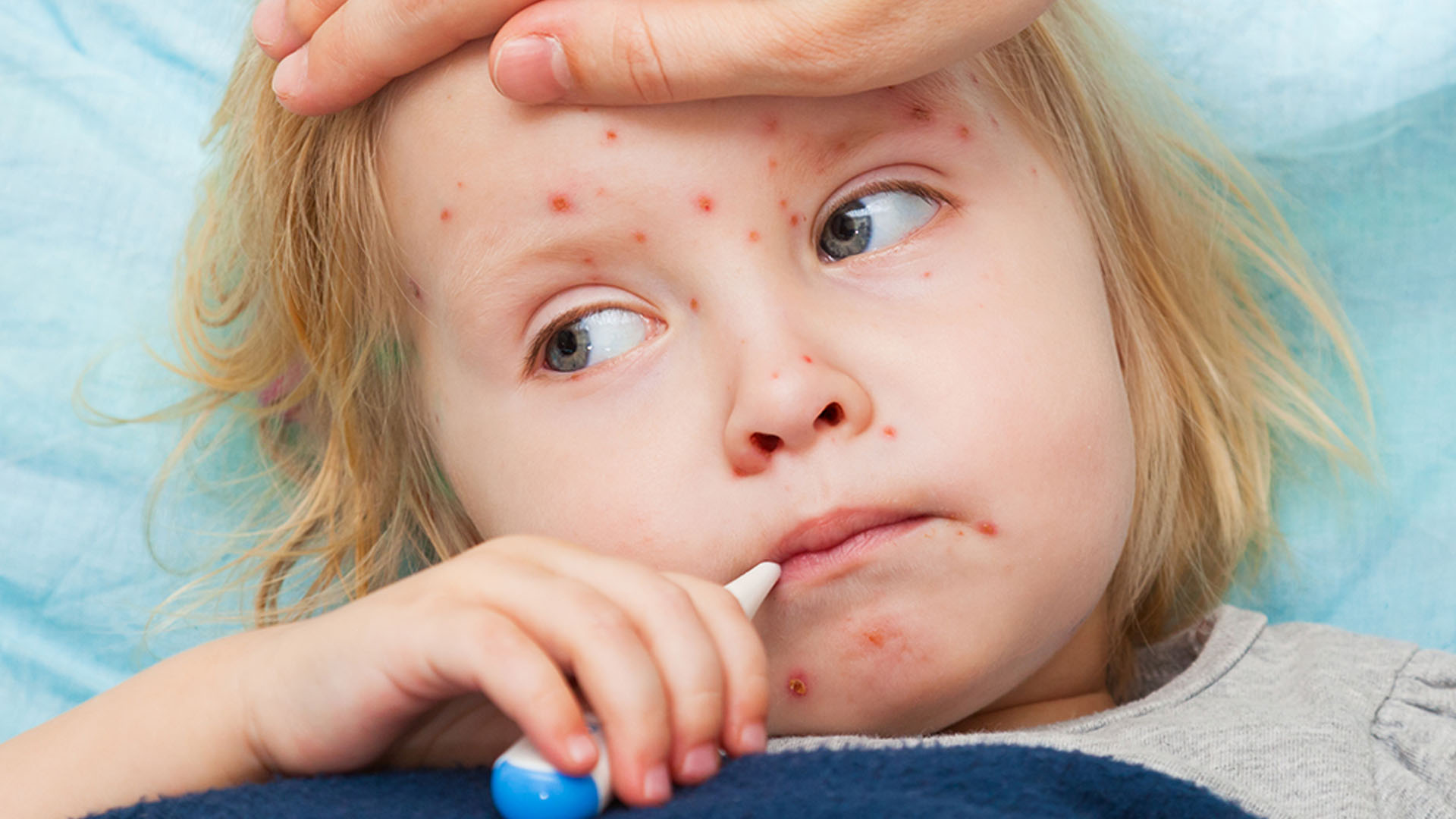 Профилактика кори