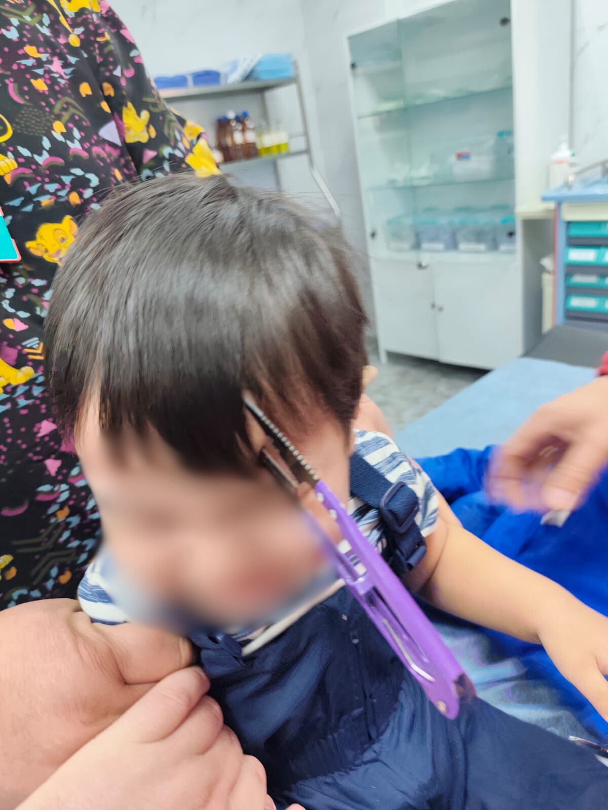 ДӘРІГЕРЛЕР БАЛАНЫ ҚҰТҚАРДЫ: ЕКІ ЖАСТАҒЫ СӘБИ ҚАЙШЫҒА ҚҰЛАП, БАСЫНАН ӨТКІР ЕНГЕН ЖАРАҚАТ АЛДЫ