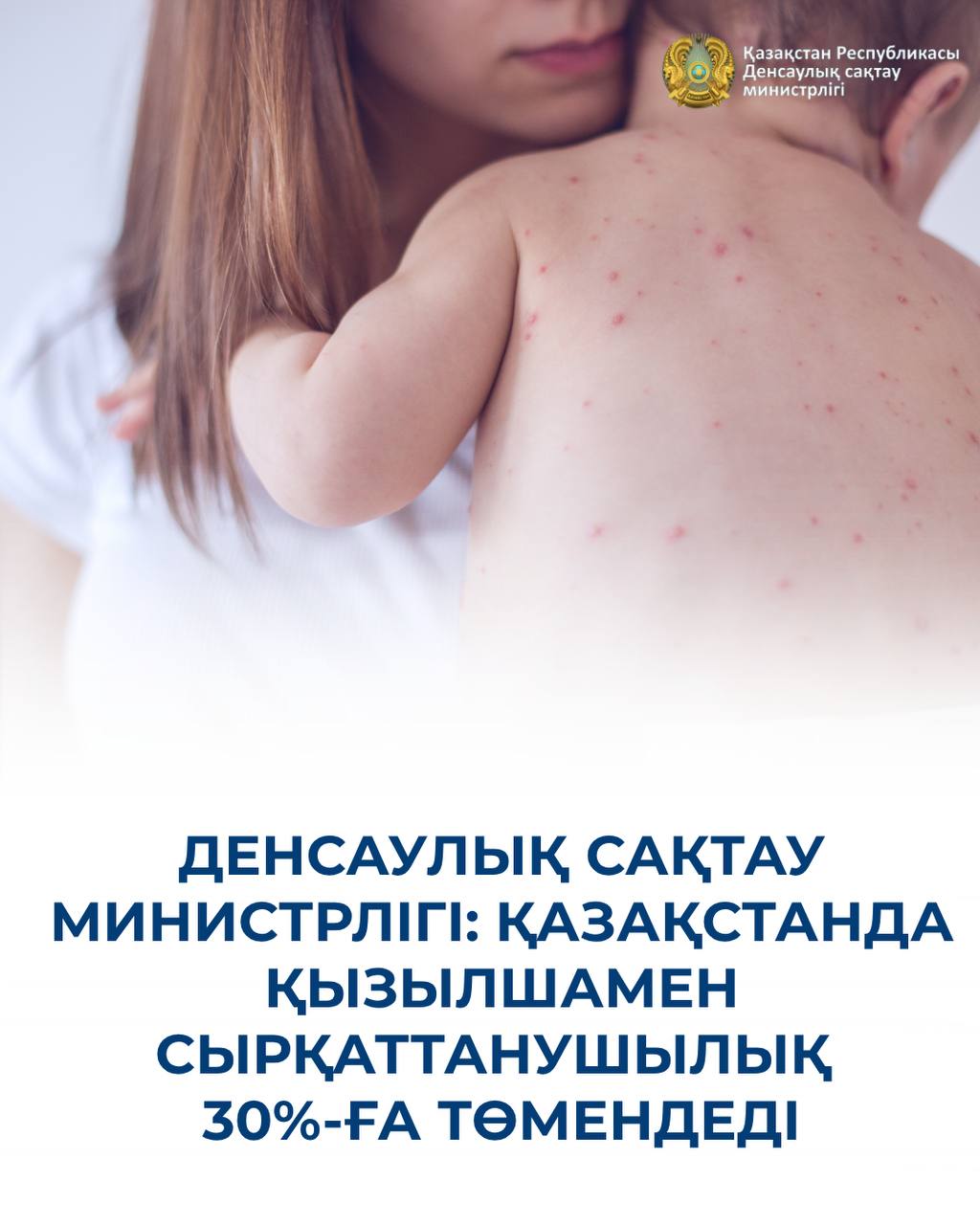ДЕНСАУЛЫҚ САҚТАУ МИНИСТРЛІГІ: ҚАЗАҚСТАНДА ҚЫЗЫЛШАМЕН СЫРҚАТТАНУШЫЛЫҚ 30%-ҒА ТӨМЕНДЕДІ